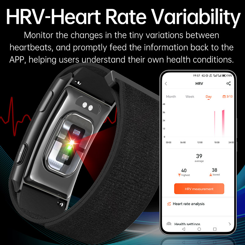 VWAR LOOP X ECG Smart Bracelet - đánh giá và giá Xbody Health & Wellness Functional Integrative Medicine Office & Medical Spa